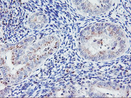 HES1 Antibody in Immunohistochemistry (Paraffin) (IHC (P))