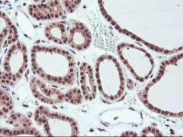 HES1 Antibody in Immunohistochemistry (Paraffin) (IHC (P))