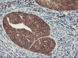 HES1 Antibody in Immunohistochemistry (Paraffin) (IHC (P))