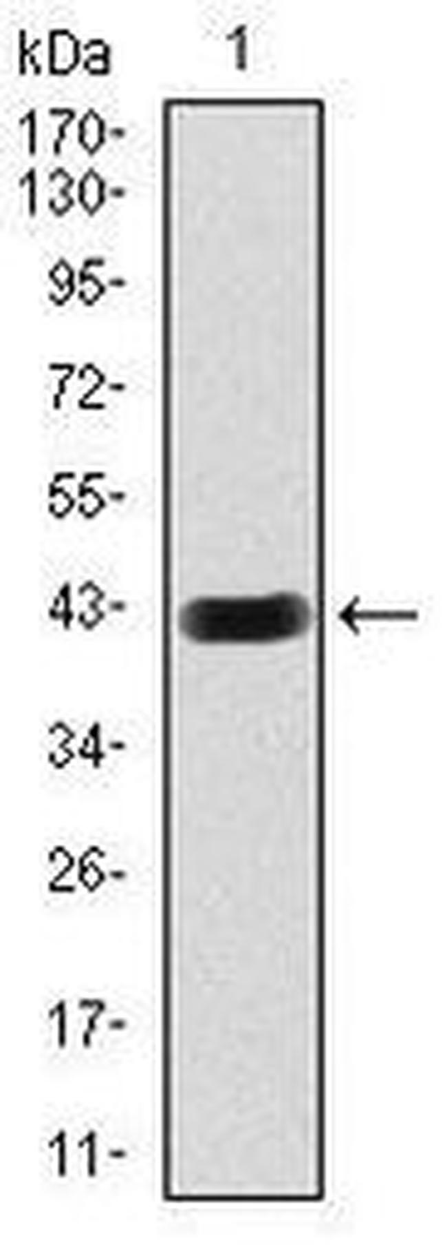 HEXA Antibody in Western Blot (WB)