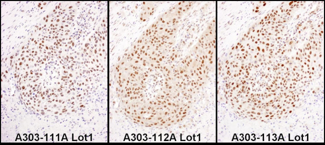 HEXIM1 Antibody in Immunohistochemistry (IHC)