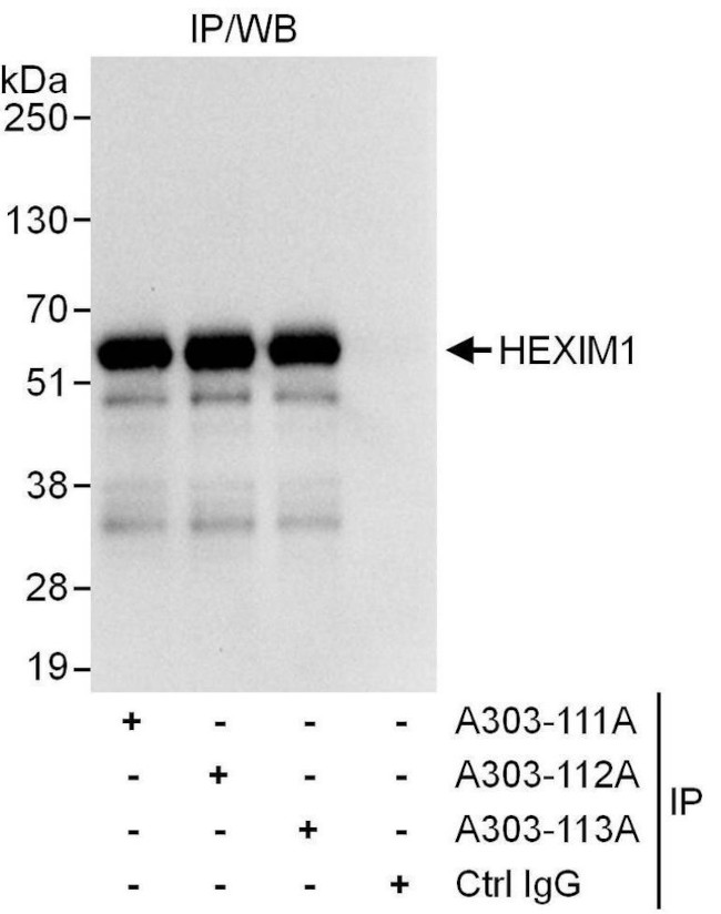 HEXIM1 Antibody in Immunoprecipitation (IP)