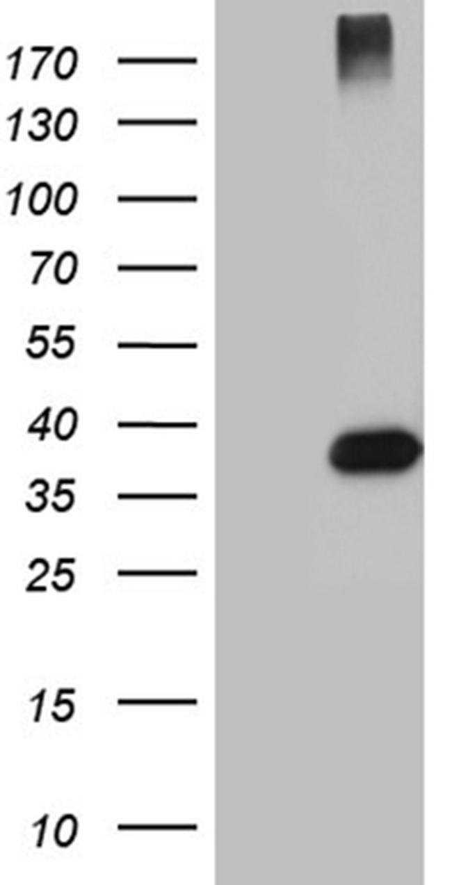 HFE2 Antibody in Western Blot (WB)