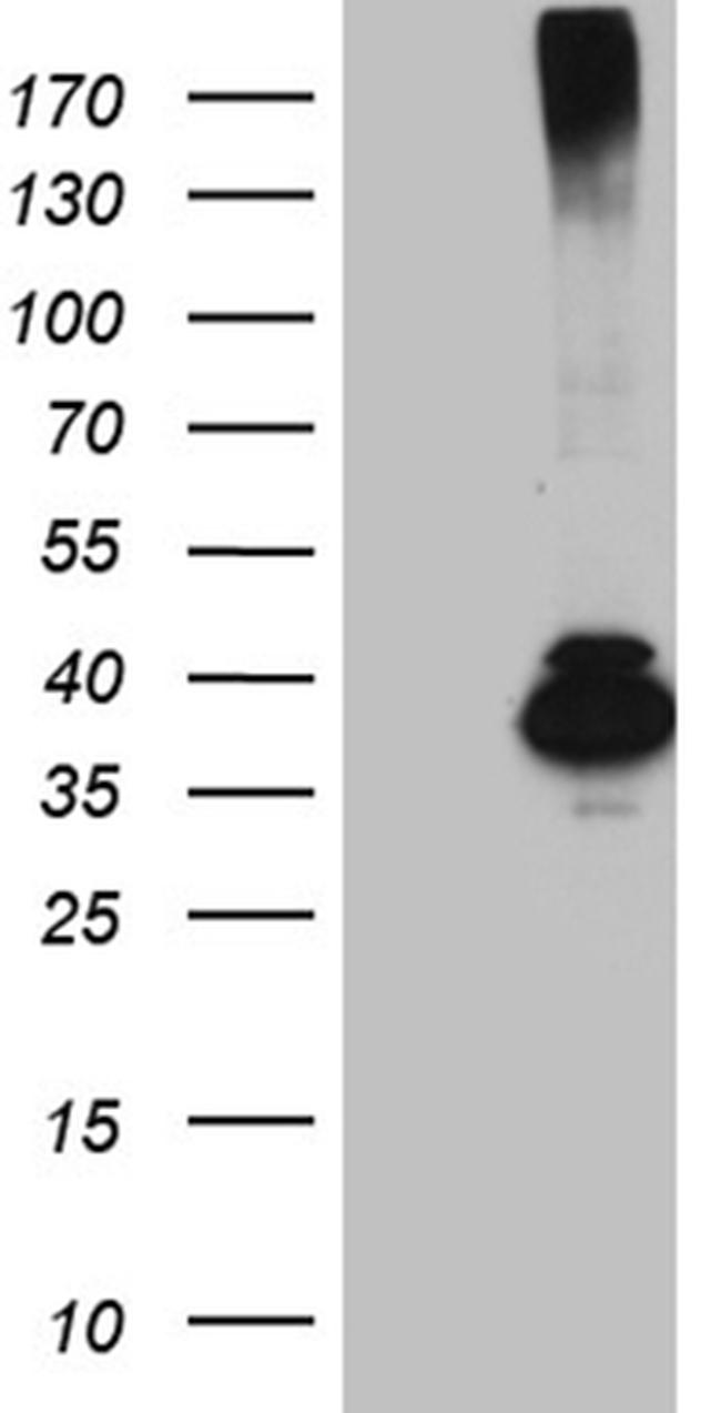 HFE2 Antibody in Western Blot (WB)