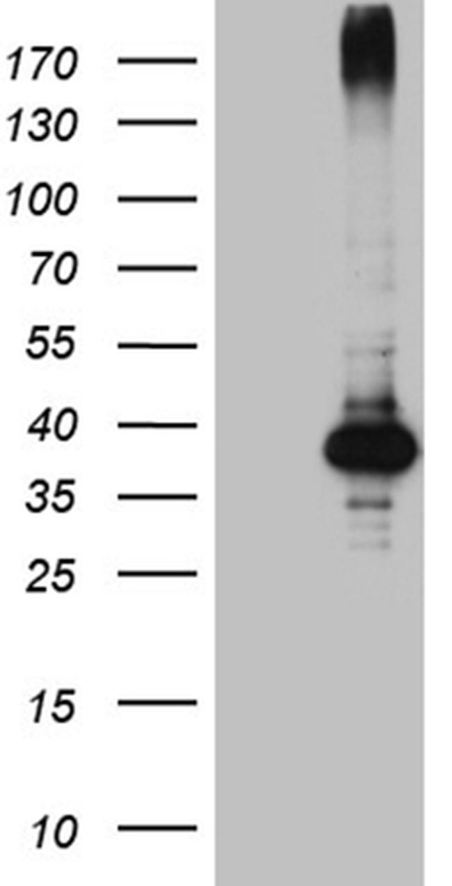 HFE2 Antibody in Western Blot (WB)