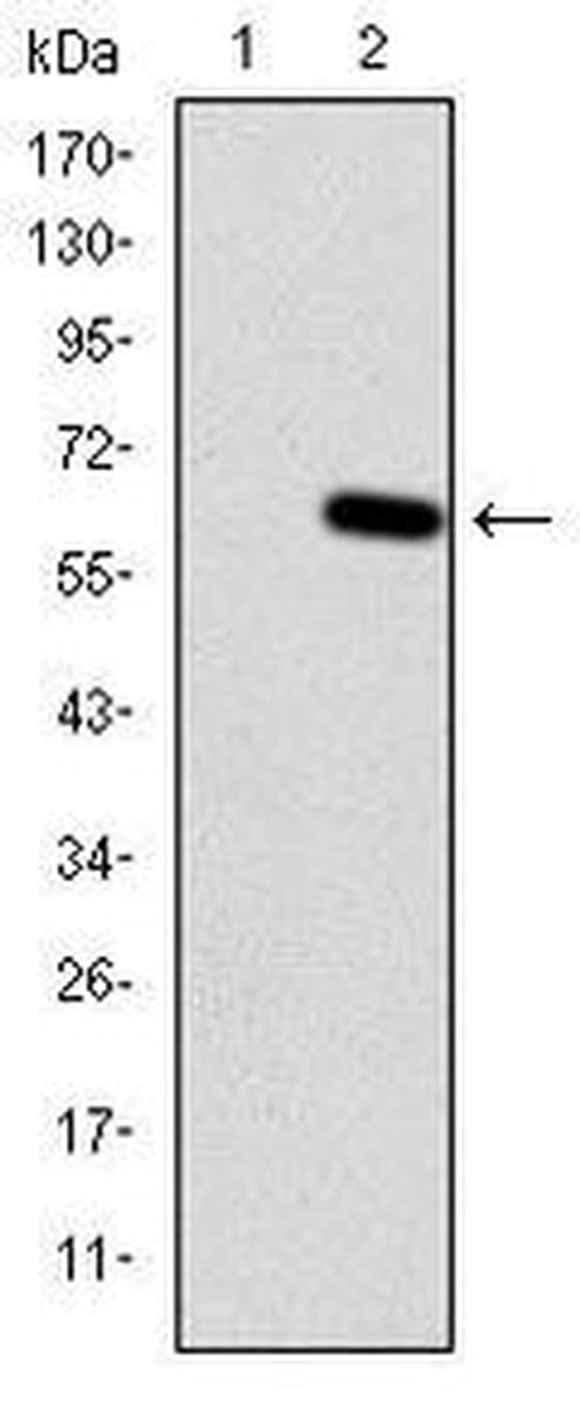 HFE Antibody in Western Blot (WB)