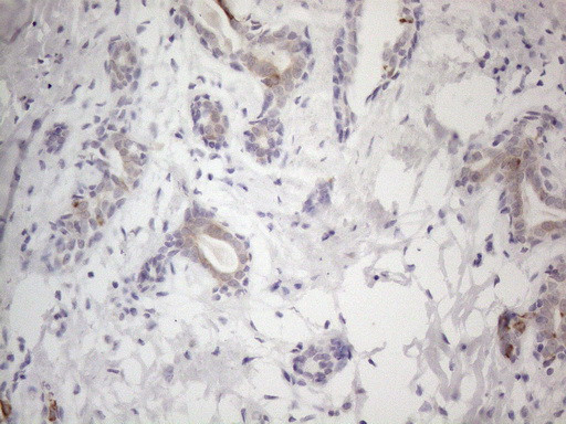 HGF Antibody in Immunohistochemistry (Paraffin) (IHC (P))