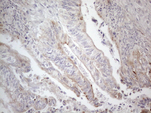 HGF Antibody in Immunohistochemistry (Paraffin) (IHC (P))