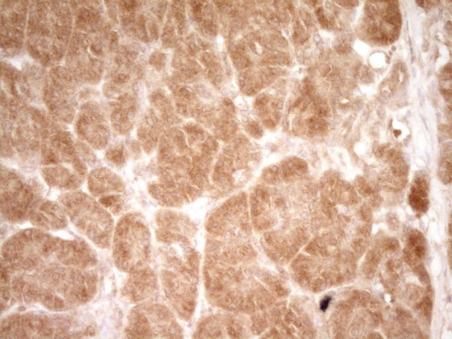 HGF Antibody in Immunohistochemistry (Paraffin) (IHC (P))