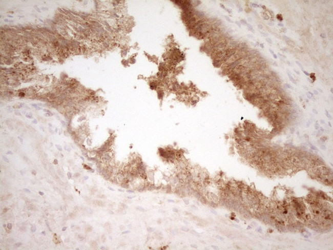 HGF Antibody in Immunohistochemistry (Paraffin) (IHC (P))