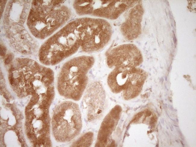 HGF Antibody in Immunohistochemistry (Paraffin) (IHC (P))