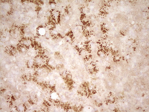 HGF Antibody in Immunohistochemistry (Paraffin) (IHC (P))