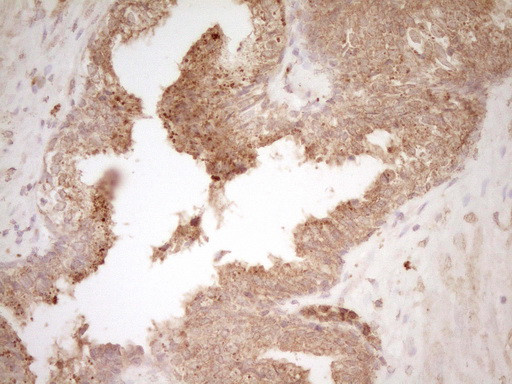 HGF Antibody in Immunohistochemistry (Paraffin) (IHC (P))