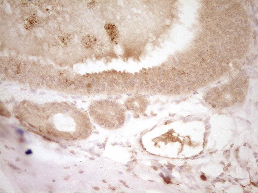 HGF Antibody in Immunohistochemistry (Paraffin) (IHC (P))