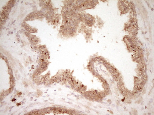 HGF Antibody in Immunohistochemistry (Paraffin) (IHC (P))