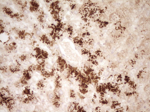 HGF Antibody in Immunohistochemistry (Paraffin) (IHC (P))