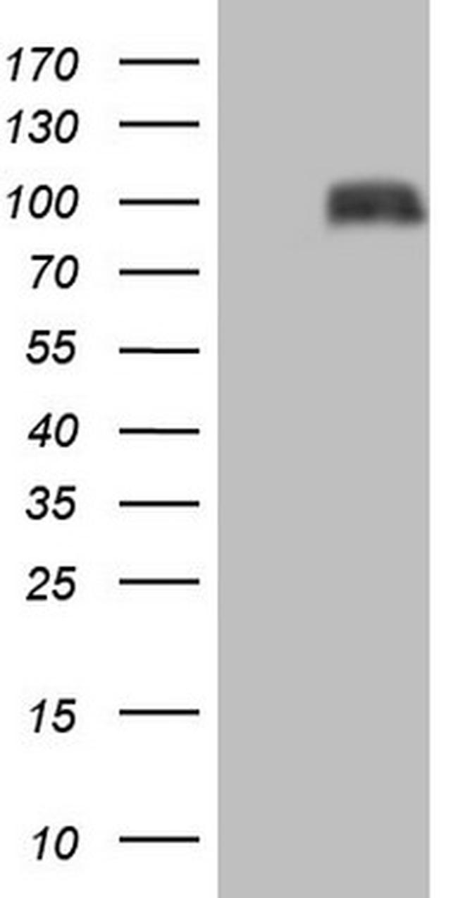 HGF Antibody in Western Blot (WB)