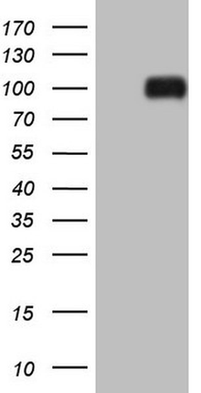 HGF Antibody in Western Blot (WB)