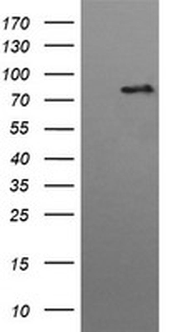 HGS Antibody in Western Blot (WB)