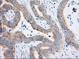 HIBCH Antibody in Immunohistochemistry (Paraffin) (IHC (P))