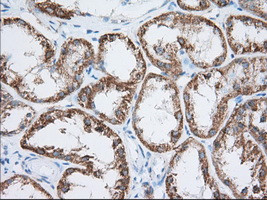 HIBCH Antibody in Immunohistochemistry (Paraffin) (IHC (P))