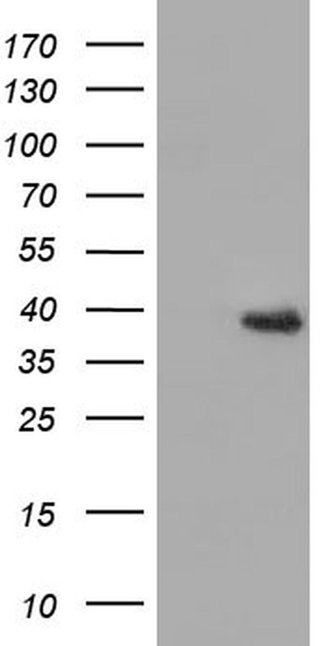 HIBCH Antibody in Western Blot (WB)