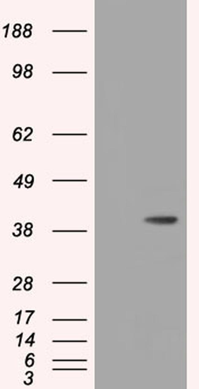 HIBCH Antibody in Western Blot (WB)