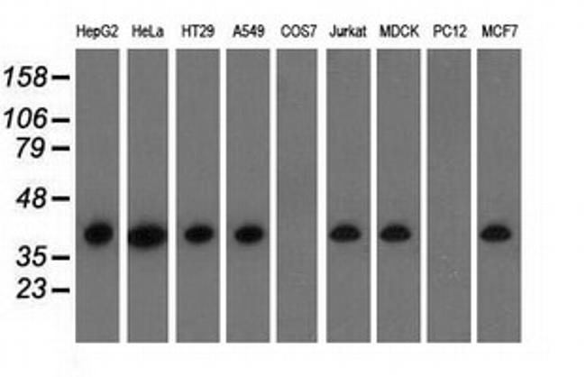 HIBCH Antibody in Western Blot (WB)