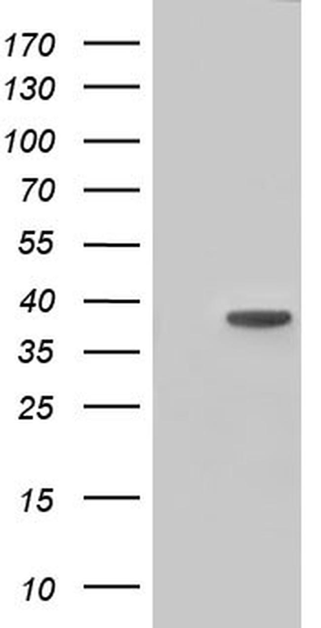 HIBCH Antibody in Western Blot (WB)