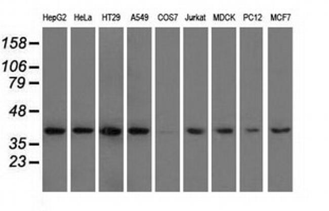 HIBCH Antibody in Western Blot (WB)