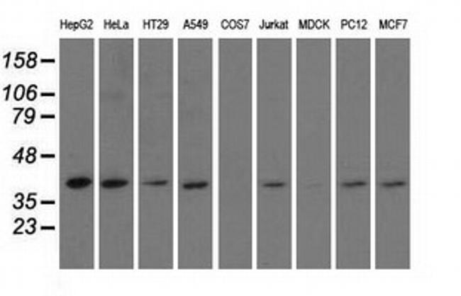 HIBCH Antibody in Western Blot (WB)