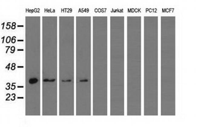 HIBCH Antibody in Western Blot (WB)