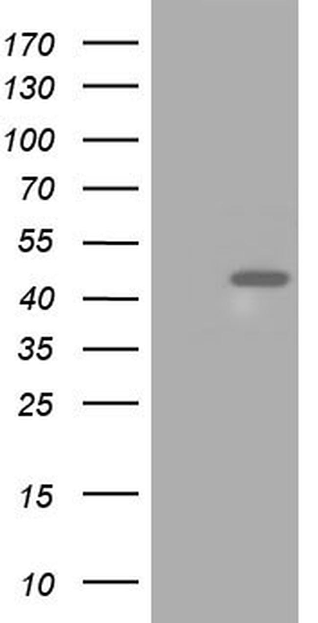 HIBCH Antibody in Western Blot (WB)