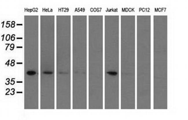 HIBCH Antibody in Western Blot (WB)