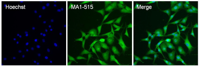 HIF-1 beta Antibody in Immunocytochemistry (ICC/IF)