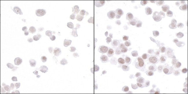 HIF2-alpha Antibody in Immunocytochemistry (ICC/IF)