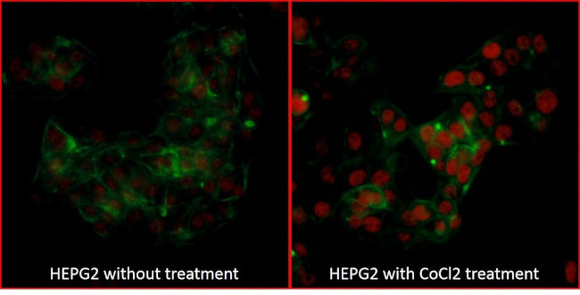 HIF2-alpha Antibody in Immunocytochemistry (ICC/IF)