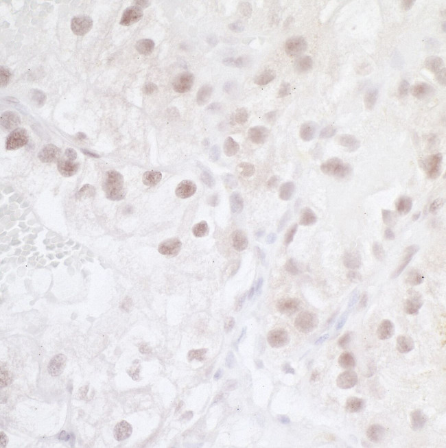 HIF2-alpha Antibody in Immunohistochemistry (IHC)