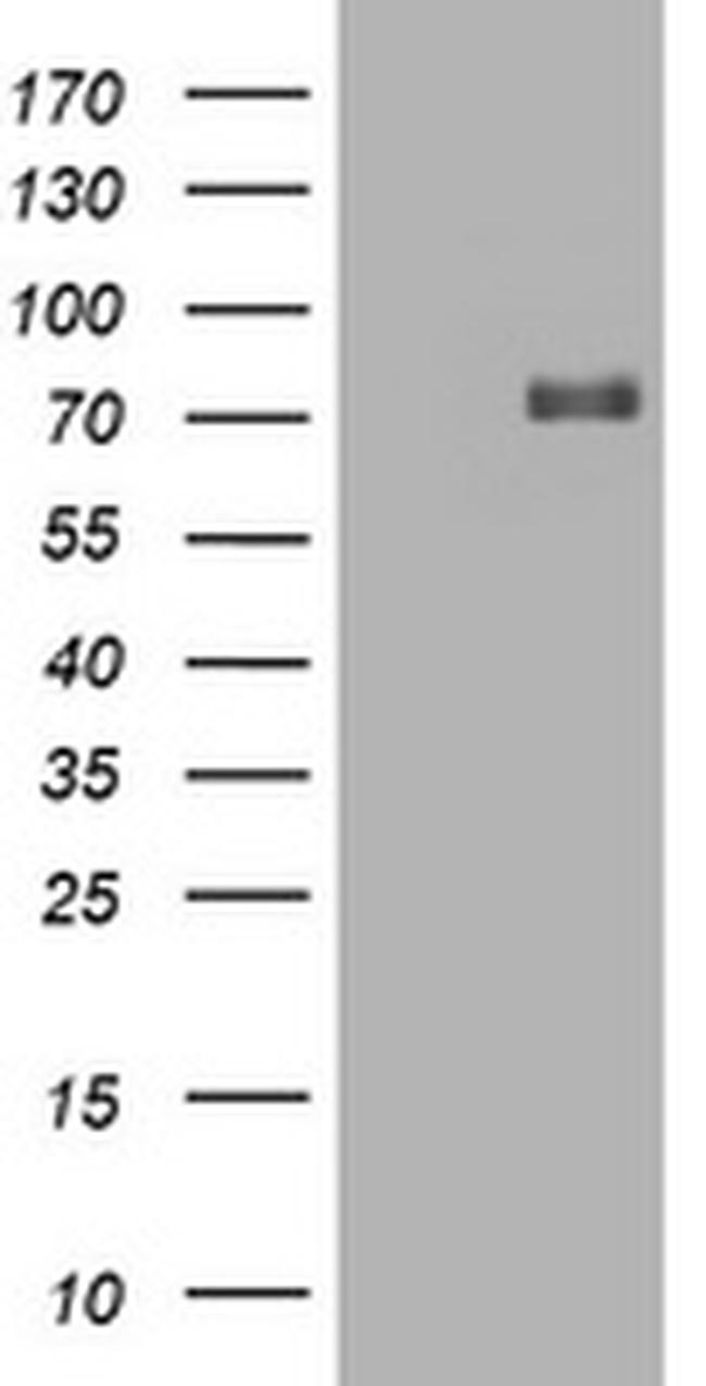 HIF3A Antibody in Western Blot (WB)