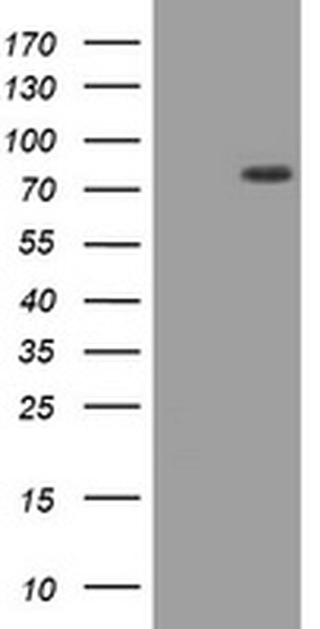 HIF3A Antibody in Western Blot (WB)