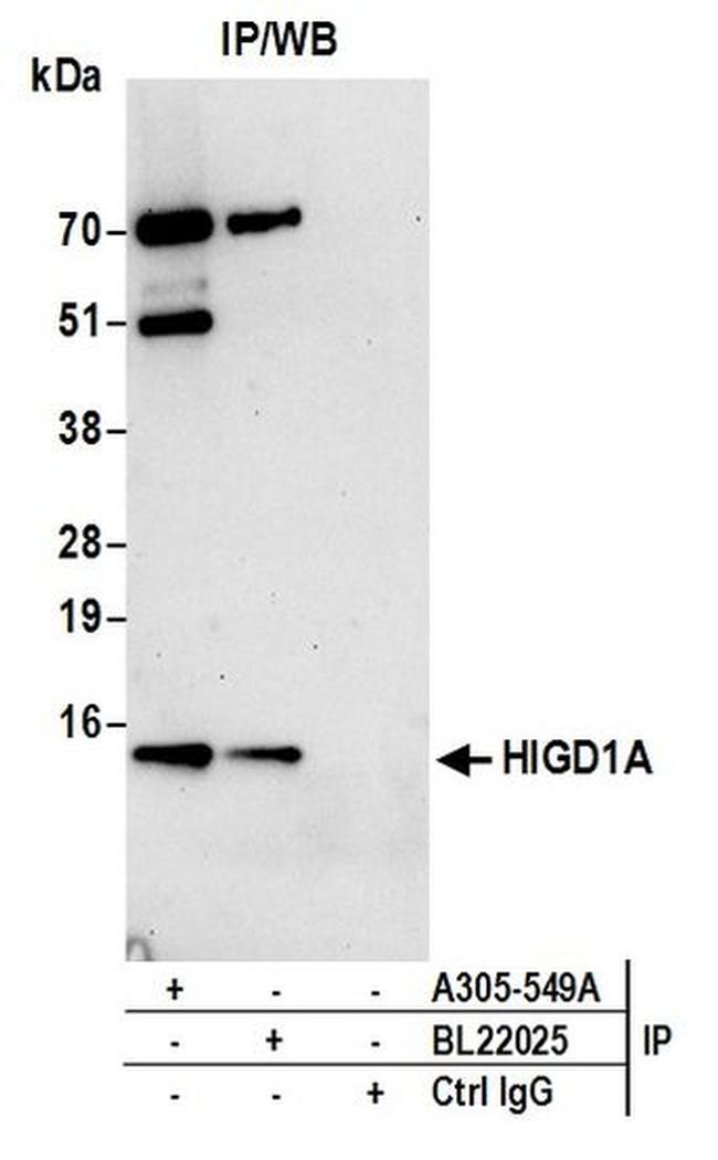 HIGD1A Antibody in Western Blot (WB)