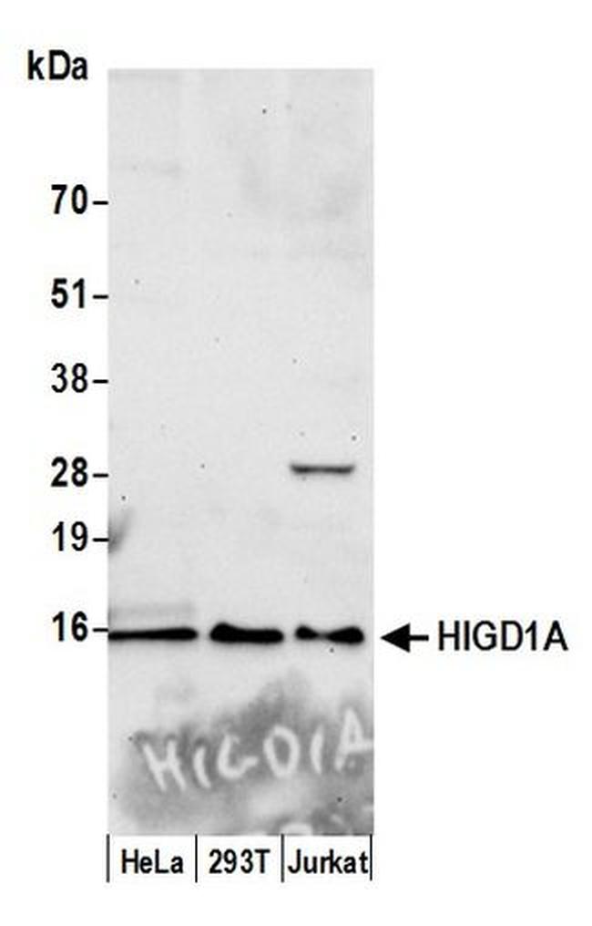 HIGD1A Antibody in Western Blot (WB)