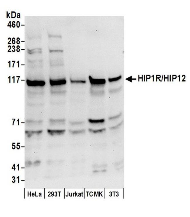 HIP1R/HIP12 Antibody in Western Blot (WB)