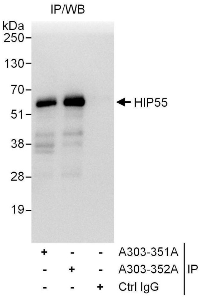 HIP55 Antibody in Immunoprecipitation (IP)