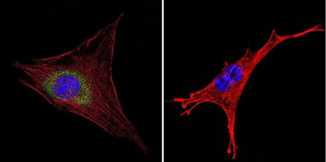 HIP Antibody in Immunocytochemistry (ICC/IF)