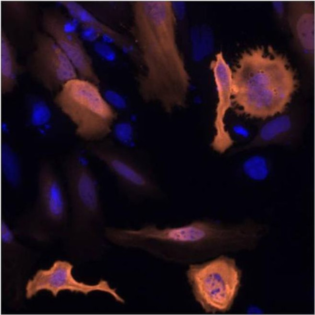 6x-His Tag Antibody in Immunocytochemistry (ICC/IF)