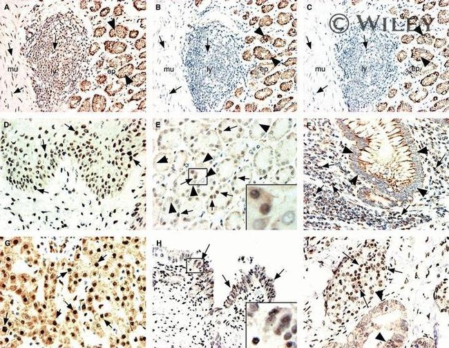 Glucocorticoid Receptor Antibody in Immunohistochemistry (Paraffin) (IHC (P))