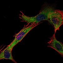 HK1 Antibody in Immunocytochemistry (ICC/IF)