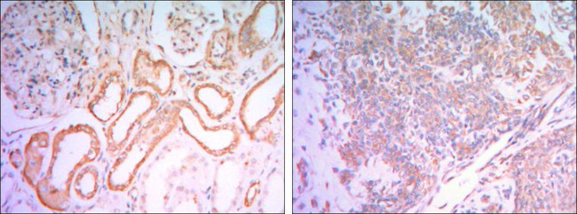 HK1 Antibody in Immunohistochemistry (Paraffin) (IHC (P))