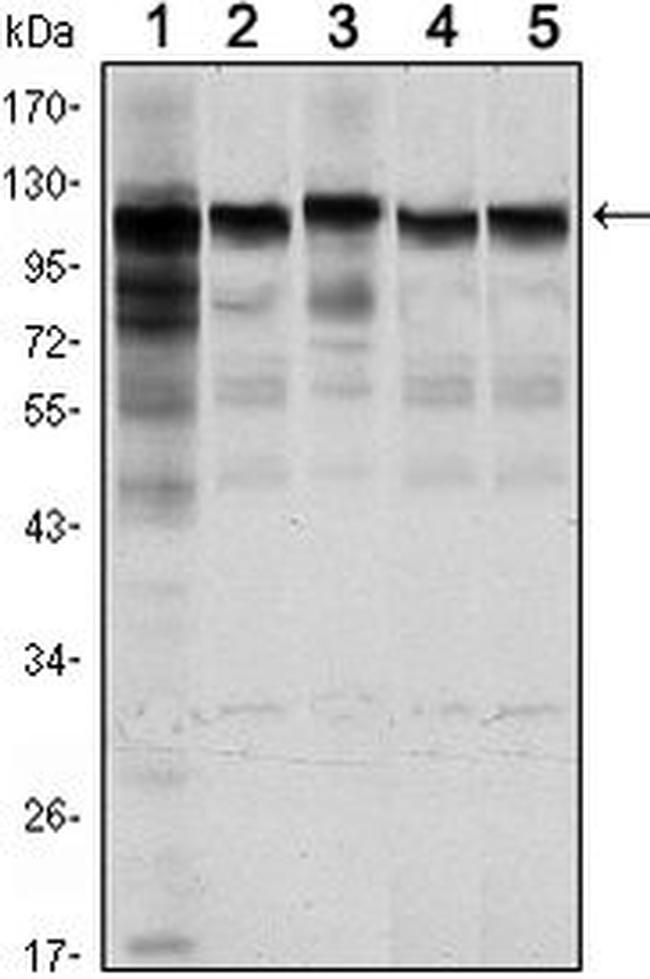 HK1 Antibody in Western Blot (WB)